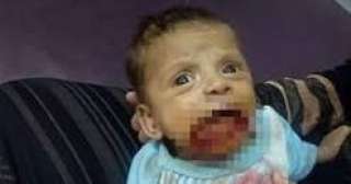 أول صور للطفل ضحية زوج والدته في الإسماعيلية