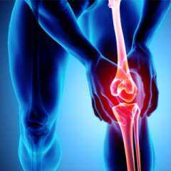 علاج خشونة الركبة، وأهم أسبابها