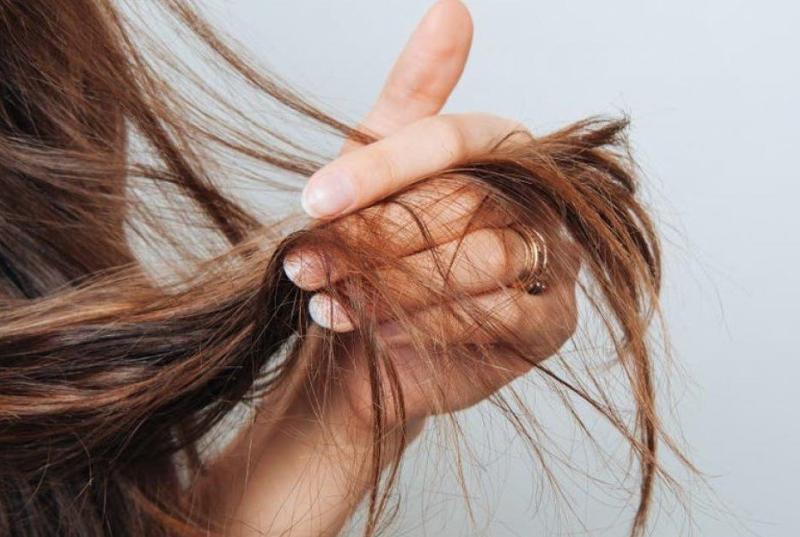 علاج تساقط الشعر