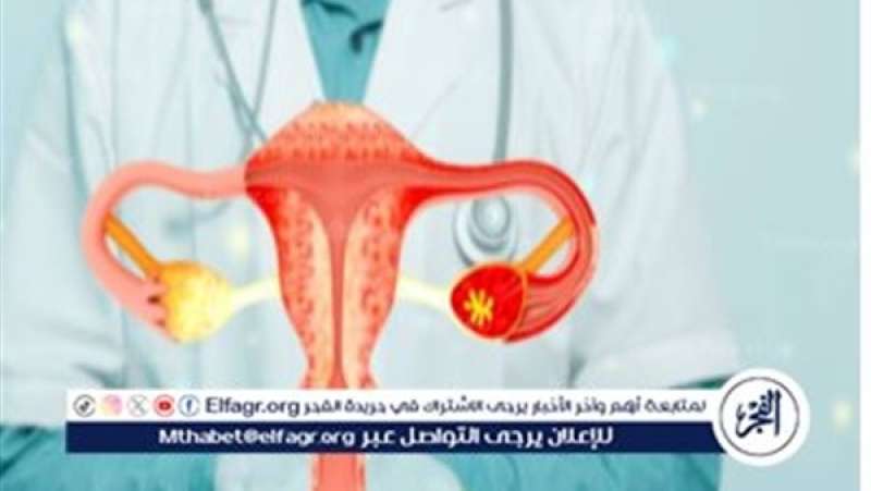 الرأي العام